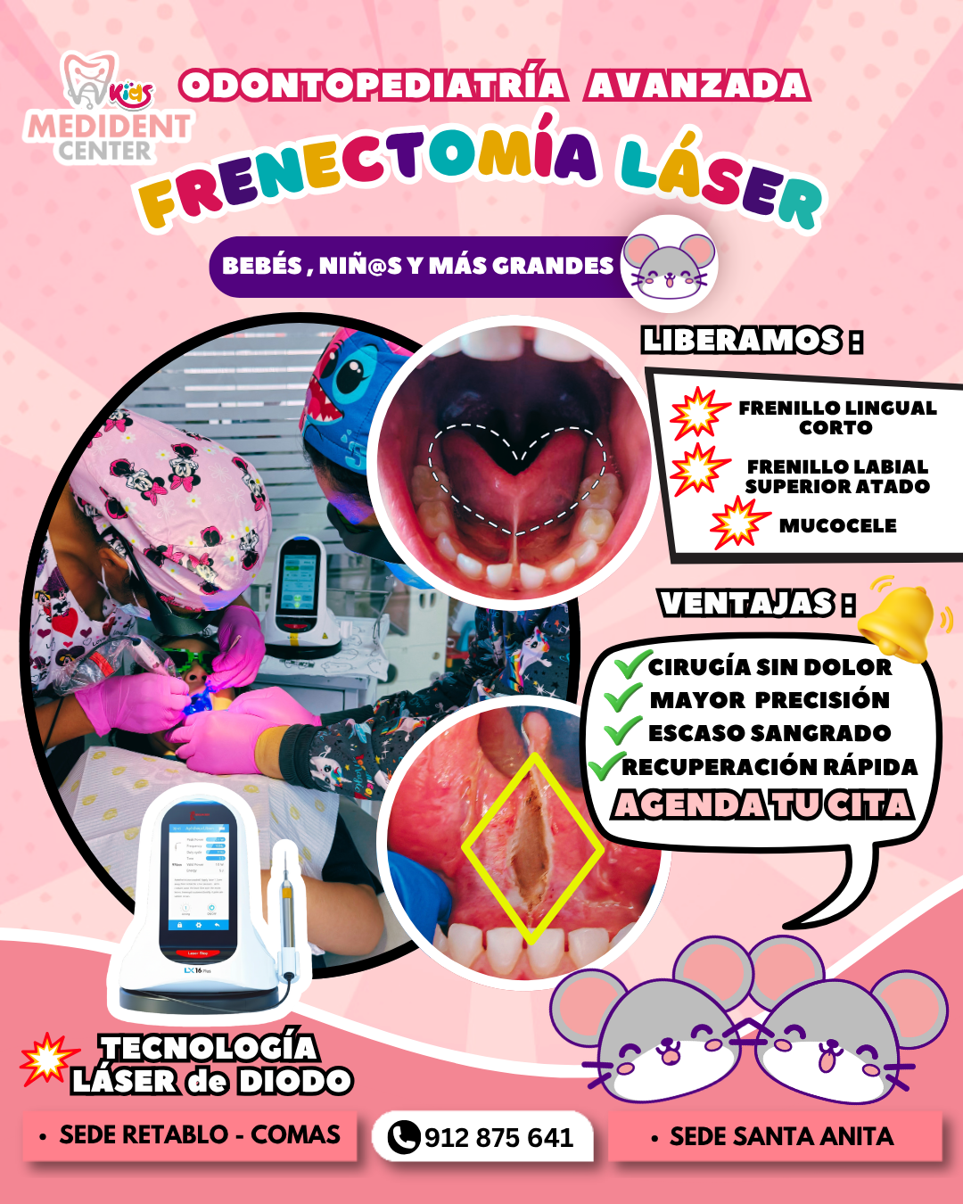 Frenectomía Láser Medident Center